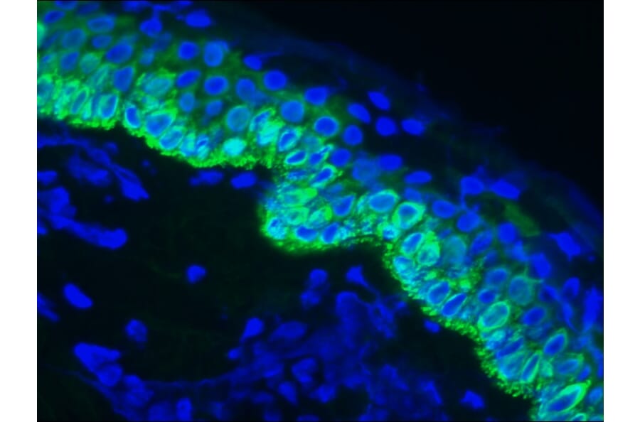 Immunofluorescence - Anti-Cytokeratin 14 Antibody [RCK107] (A115538) - Antibodies.com