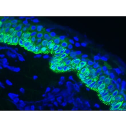 Immunofluorescence - Anti-Cytokeratin 14 Antibody [RCK107] (A115538) - Antibodies.com