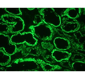 Immunohistochemistry - Anti-Cytokeratin 18 Antibody [RGE53] (A115541) - Antibodies.com
