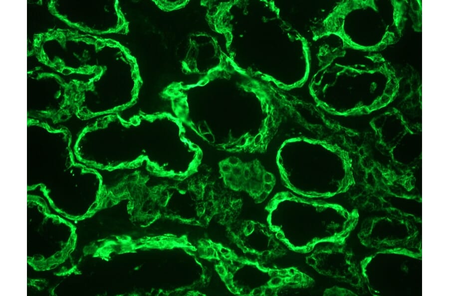 Immunohistochemistry - Anti-Cytokeratin 18 Antibody [RGE53] (A115541) - Antibodies.com