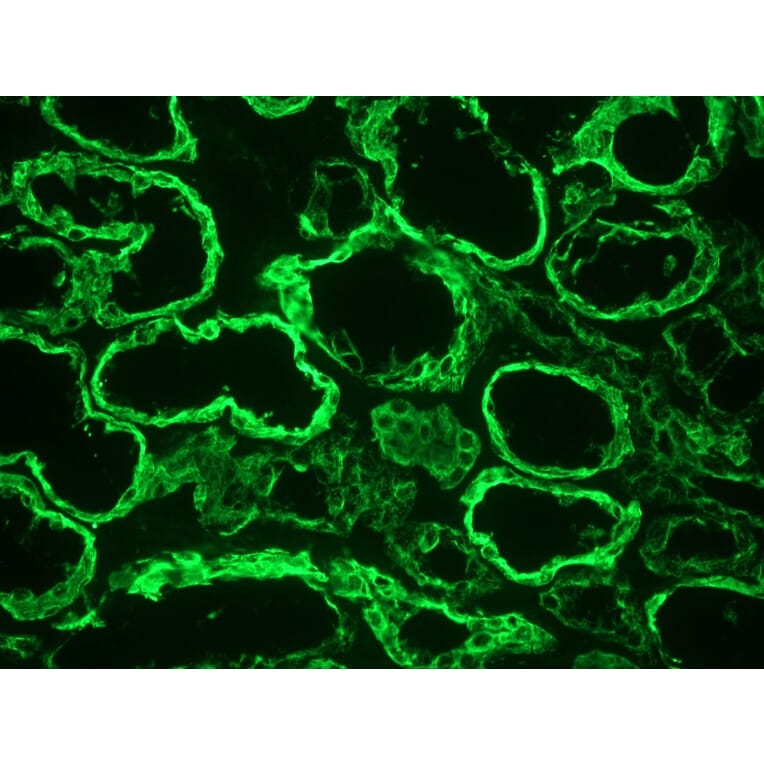 Immunohistochemistry - Anti-Cytokeratin 18 Antibody [RGE53] (A115541) - Antibodies.com