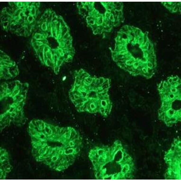 Immunohistochemistry - Anti-Cytokeratin 18 Antibody [RGE53] (A115541) - Antibodies.com