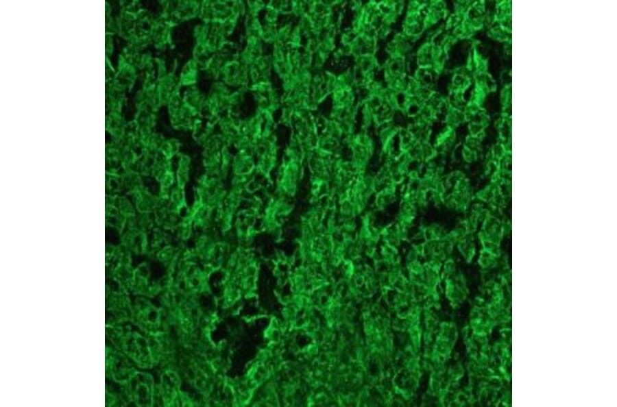 Immunohistochemistry - Anti-Cytokeratin 18 Antibody [RGE53] (A115541) - Antibodies.com