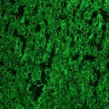 Immunohistochemistry - Anti-Cytokeratin 18 Antibody [RGE53] (A115541) - Antibodies.com