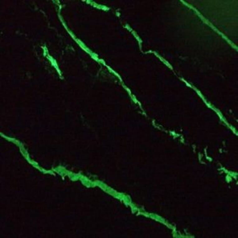 Immunofluorescence - Anti-Cytokeratin 18 Antibody [RGE53] (A115541) - Antibodies.com
