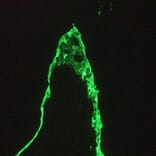 Immunofluorescence - Anti-Cytokeratin 18 Antibody [RGE53] (A115541) - Antibodies.com