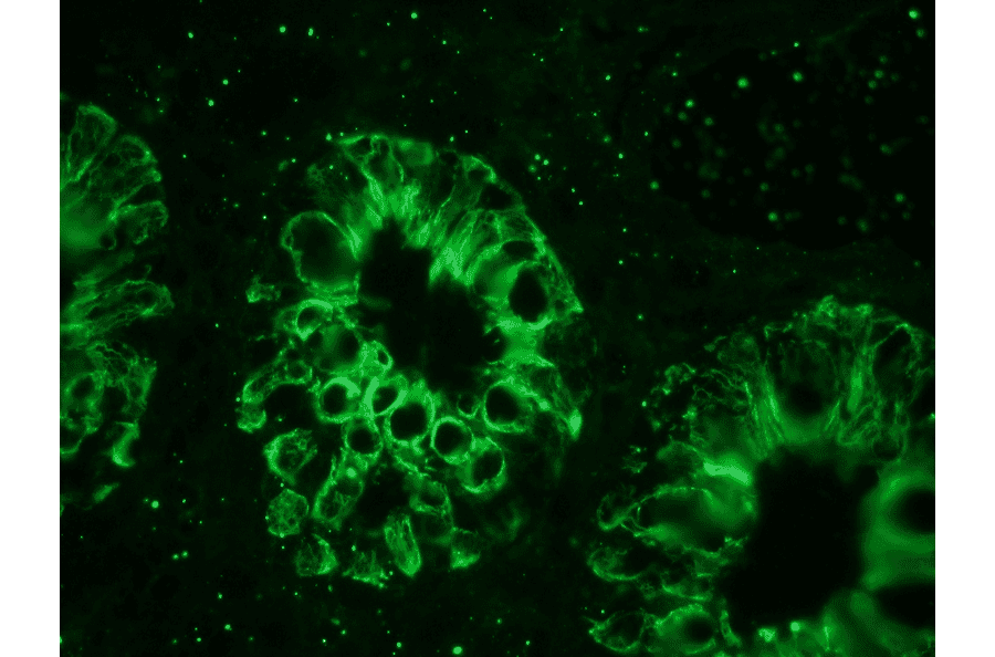 Immunofluorescence - Anti-Cytokeratin 18 Antibody [RGE53] (A115541) - Antibodies.com