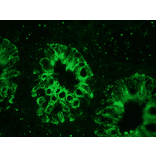 Immunofluorescence - Anti-Cytokeratin 18 Antibody [RGE53] (A115541) - Antibodies.com