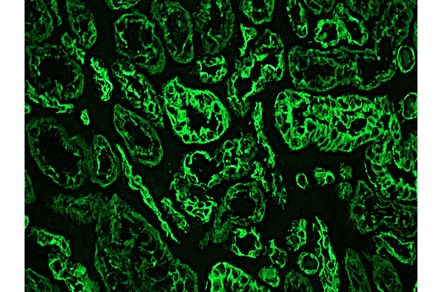 Immunofluorescence - Anti-Cytokeratin 18 Antibody [RCK106] (A115542) - Antibodies.com