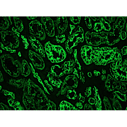 Immunofluorescence - Anti-Cytokeratin 18 Antibody [RCK106] (A115542) - Antibodies.com