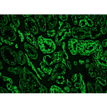 Immunofluorescence - Anti-Cytokeratin 18 Antibody [RCK106] (A115542) - Antibodies.com
