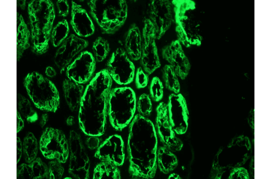 Immunofluorescence - Anti-Cytokeratin 18 Antibody [RCK106] (A115542) - Antibodies.com