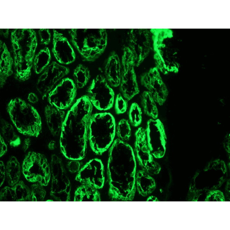 Immunofluorescence - Anti-Cytokeratin 18 Antibody [RCK106] (A115542) - Antibodies.com