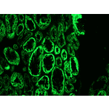 Immunofluorescence - Anti-Cytokeratin 18 Antibody [RCK106] (A115542) - Antibodies.com