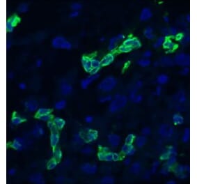 Immunohistochemistry - Anti-Cytokeratin 19 Antibody [RCK108] (A115545) - Antibodies.com