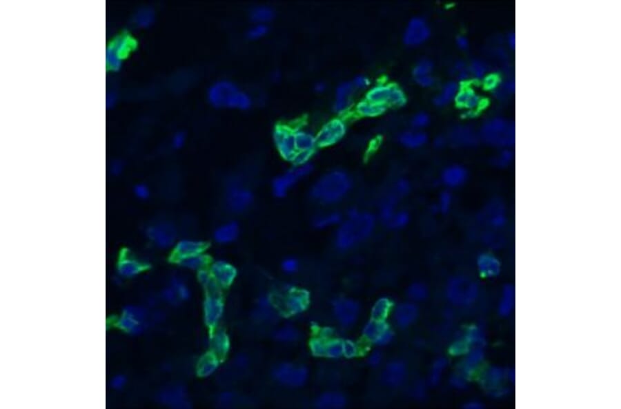 Immunohistochemistry - Anti-Cytokeratin 19 Antibody [RCK108] (A115545) - Antibodies.com