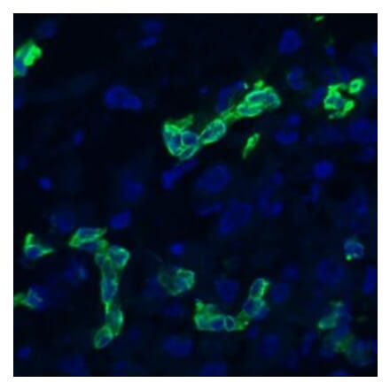 Immunohistochemistry - Anti-Cytokeratin 19 Antibody [RCK108] (A115545) - Antibodies.com