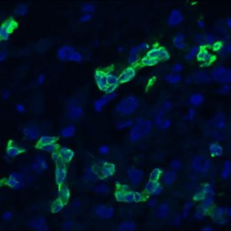 Immunohistochemistry - Anti-Cytokeratin 19 Antibody [RCK108] (A115545) - Antibodies.com