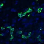 Immunohistochemistry - Anti-Cytokeratin 19 Antibody [RCK108] (A115545) - Antibodies.com