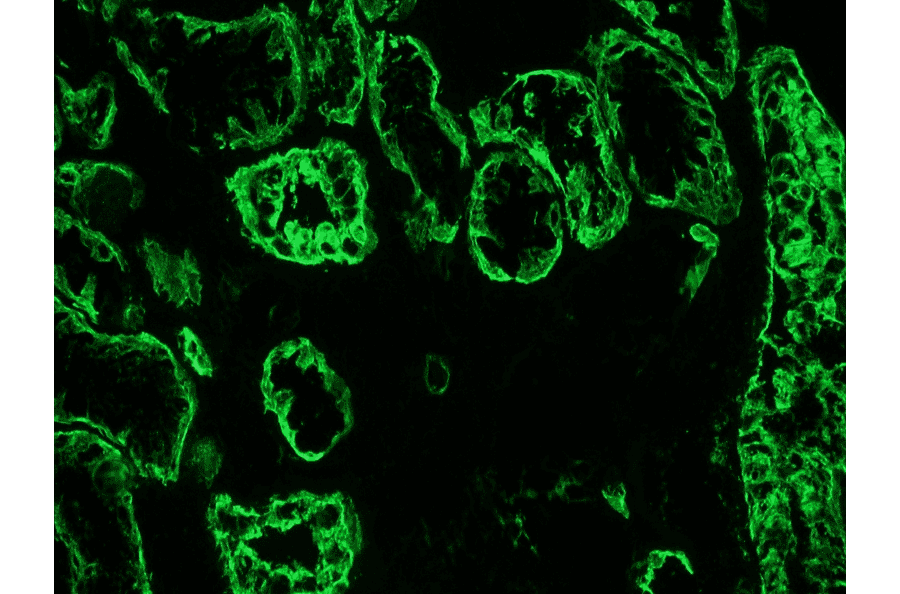 Immunohistochemistry - Anti-Cytokeratin 19 Antibody [RCK108] (A115545) - Antibodies.com