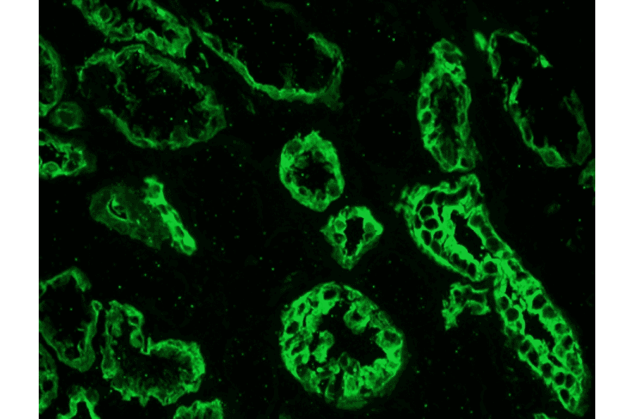 Immunohistochemistry - Anti-Cytokeratin 19 Antibody [RCK108] (A115545) - Antibodies.com
