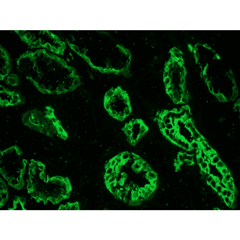Immunohistochemistry - Anti-Cytokeratin 19 Antibody [RCK108] (A115545) - Antibodies.com