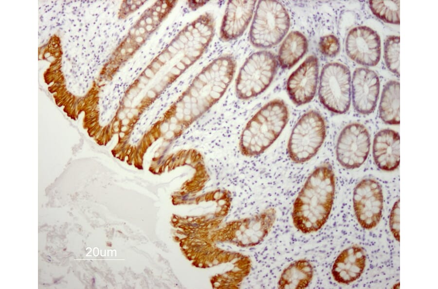 Immunohistochemistry - Paraffin - Anti-Cytokeratin 19 Antibody [RCK108] (A115545) - Antibodies.com