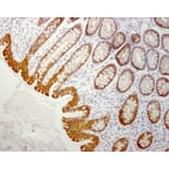 Immunohistochemistry - Paraffin - Anti-Cytokeratin 19 Antibody [RCK108] (A115545) - Antibodies.com