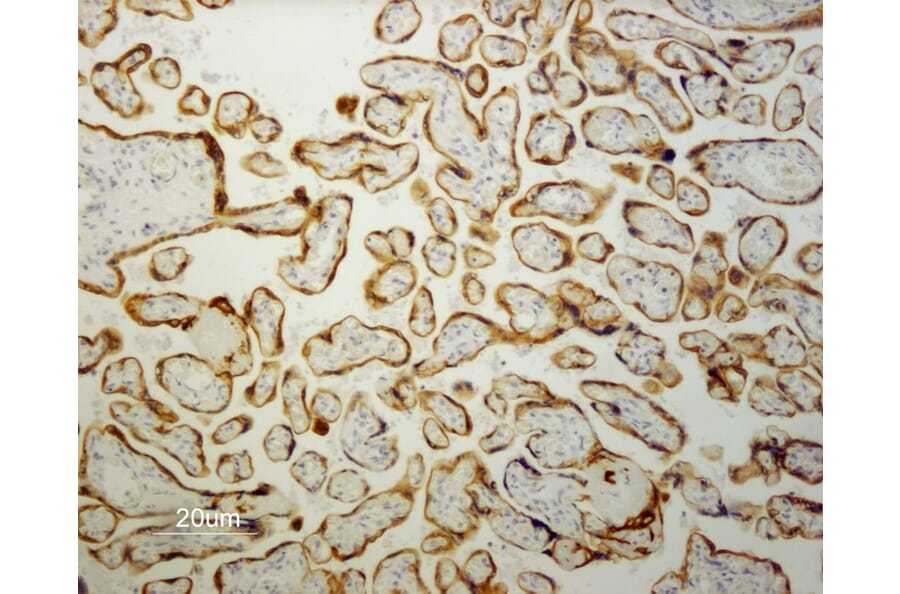 Immunohistochemistry - Paraffin - Anti-Cytokeratin 19 Antibody [RCK108] (A115545) - Antibodies.com