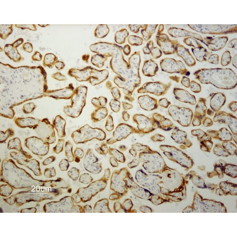 Immunohistochemistry - Paraffin - Anti-Cytokeratin 19 Antibody [RCK108] (A115545) - Antibodies.com