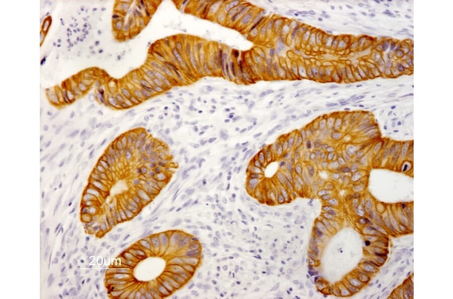 Immunohistochemistry - Paraffin - Anti-Cytokeratin 19 Antibody [RCK108] (A115545) - Antibodies.com