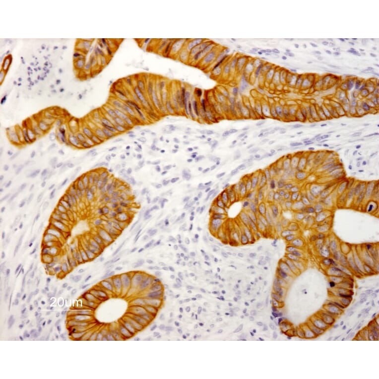 Immunohistochemistry - Paraffin - Anti-Cytokeratin 19 Antibody [RCK108] (A115545) - Antibodies.com