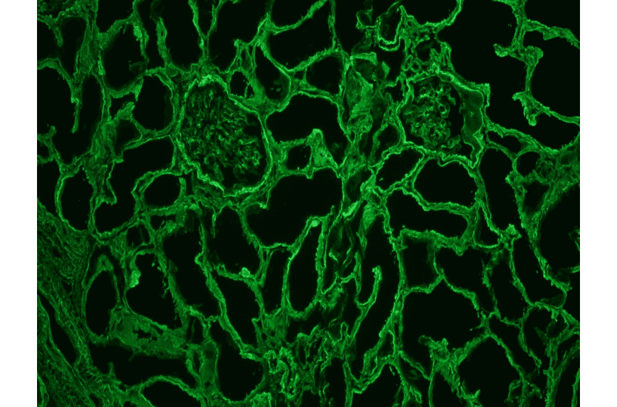 Immunohistochemistry - Frozen - Anti-Collagen IV Antibody [1043] (A115551) - Antibodies.com