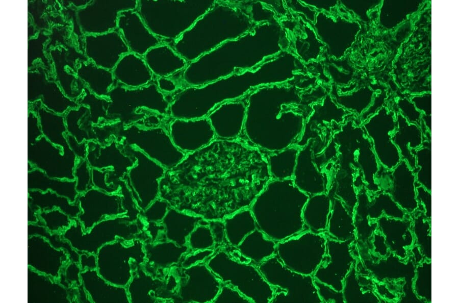 Immunohistochemistry - Frozen - Anti-Collagen IV Antibody (A115552) - Antibodies.com