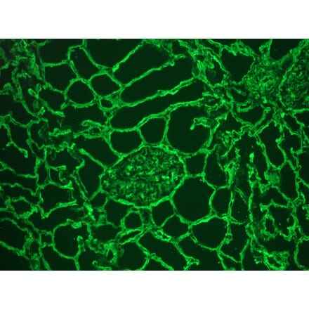 Immunohistochemistry - Frozen - Anti-Collagen IV Antibody (A115552) - Antibodies.com