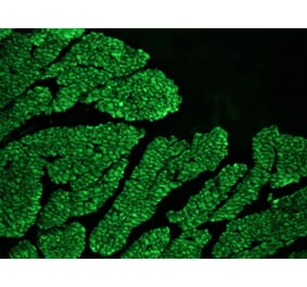 Immunohistochemistry - Anti-Desmin Antibody [RD301] (A115567) - Antibodies.com