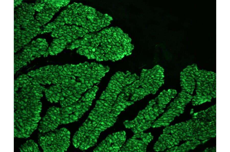 Immunohistochemistry - Anti-Desmin Antibody [RD301] (A115567) - Antibodies.com