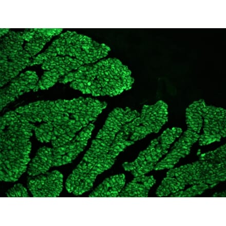 Immunohistochemistry - Anti-Desmin Antibody [RD301] (A115567) - Antibodies.com
