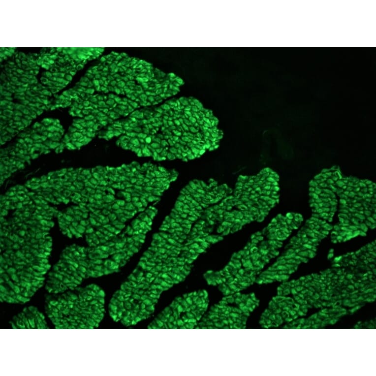 Immunohistochemistry - Anti-Desmin Antibody [RD301] (A115567) - Antibodies.com