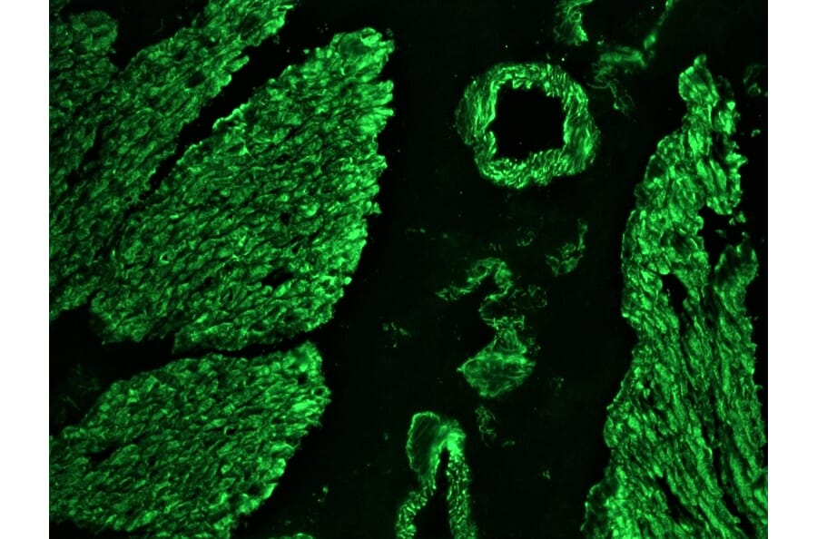 Immunohistochemistry - Anti-Desmin Antibody [RD301] (A115567) - Antibodies.com