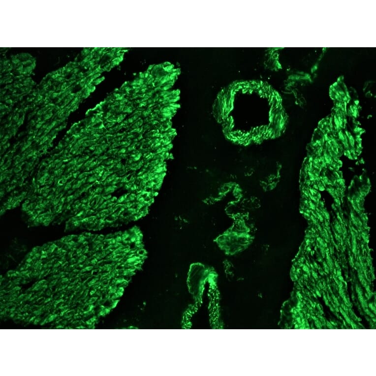 Immunohistochemistry - Anti-Desmin Antibody [RD301] (A115567) - Antibodies.com