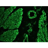Immunohistochemistry - Anti-Desmin Antibody [RD301] (A115567) - Antibodies.com