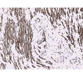 Immunohistochemistry - Anti-Desmin Antibody [D9] (A115568) - Antibodies.com