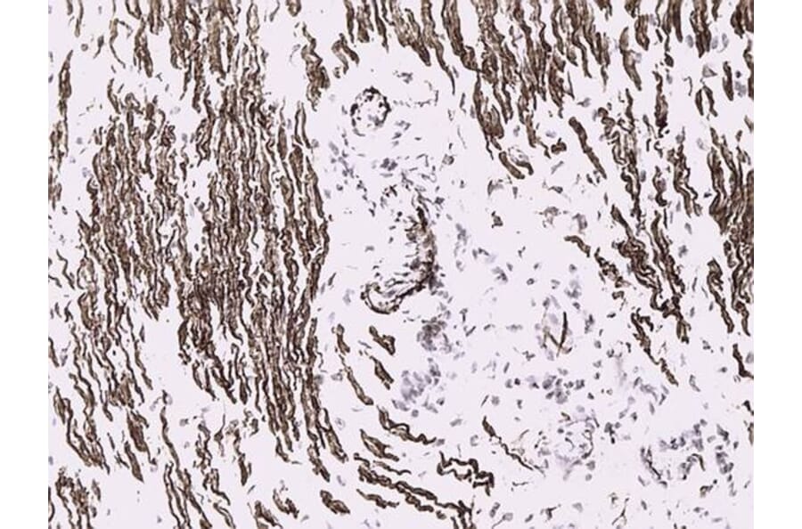 Immunohistochemistry - Anti-Desmin Antibody [D9] (A115568) - Antibodies.com