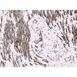 Immunohistochemistry - Anti-Desmin Antibody [D9] (A115568) - Antibodies.com