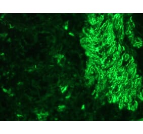 Immunohistochemistry - Anti-Desmin Antibody (A115569) - Antibodies.com