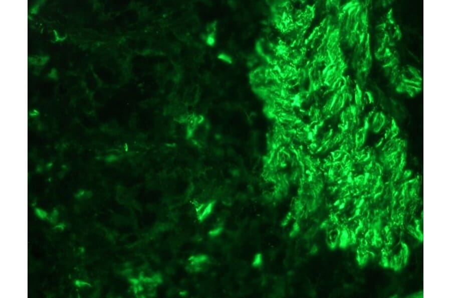 Immunohistochemistry - Anti-Desmin Antibody (A115569) - Antibodies.com