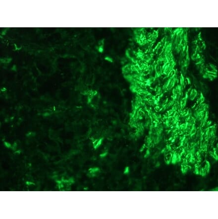 Immunohistochemistry - Anti-Desmin Antibody (A115569) - Antibodies.com