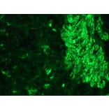 Immunohistochemistry - Anti-Desmin Antibody (A115569) - Antibodies.com