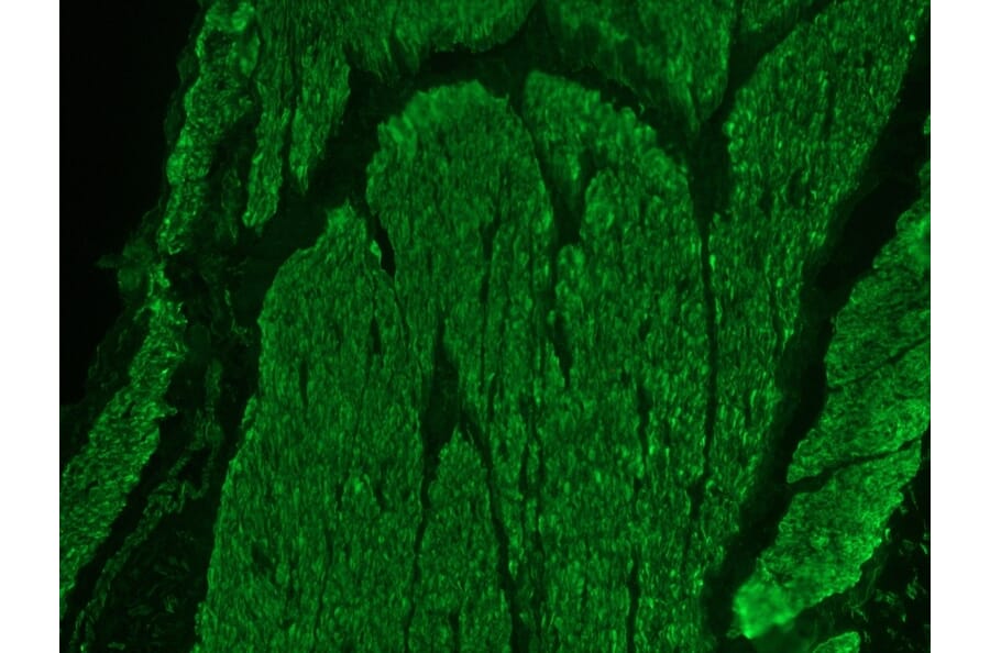 Immunohistochemistry - Anti-Desmin Antibody (A115569) - Antibodies.com